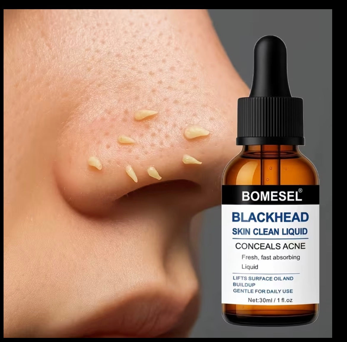 Blackhead Clearing Serum